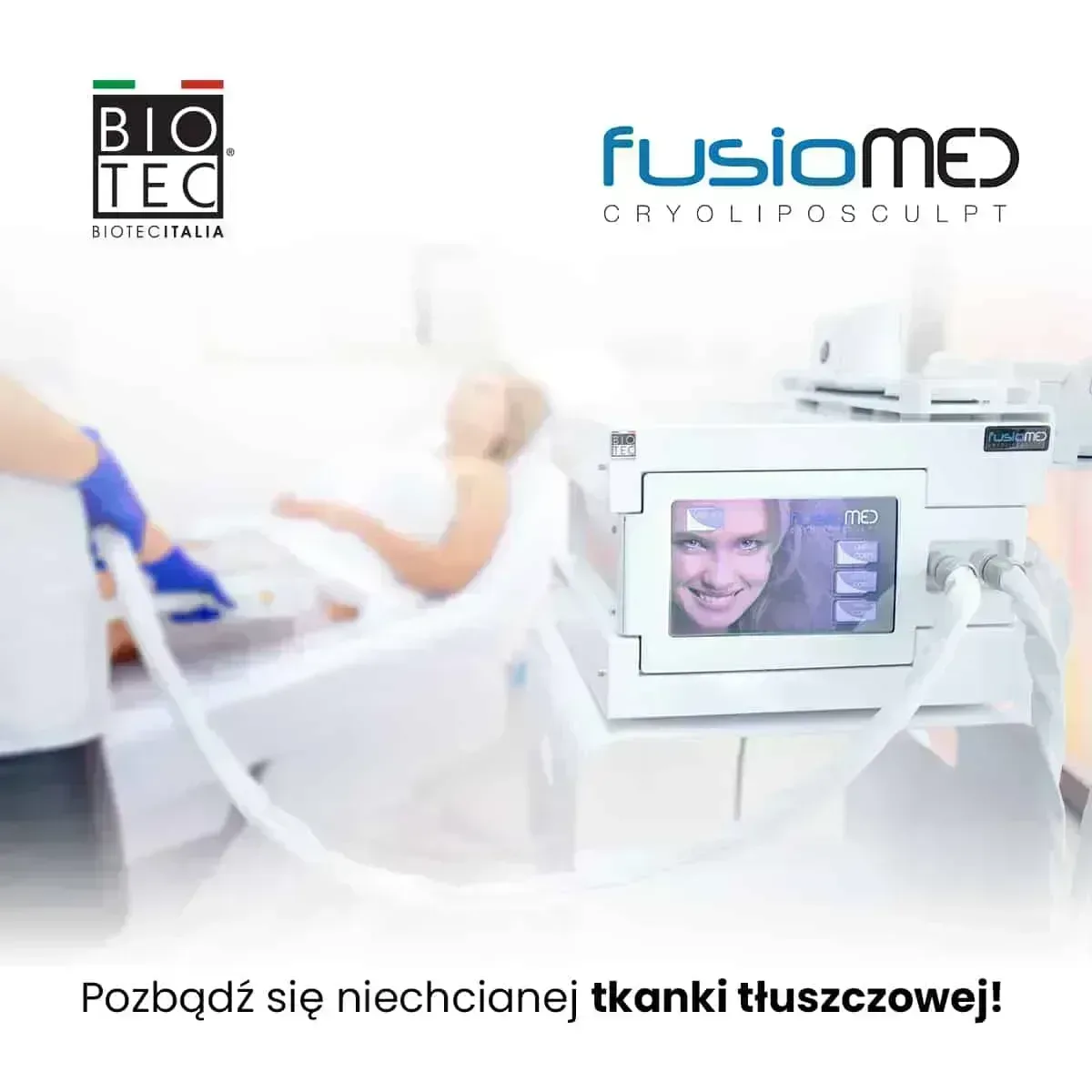 Cryoliposculpt